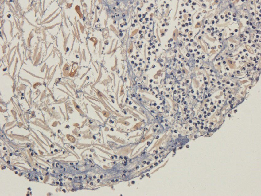 Adiponectin antibody