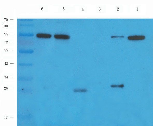 Adiponectin antibody