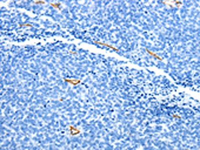 ADIPOQ Antibody