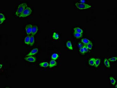 ADIPOR1 Antibody