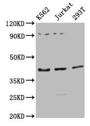 ADIPOR1 antibody