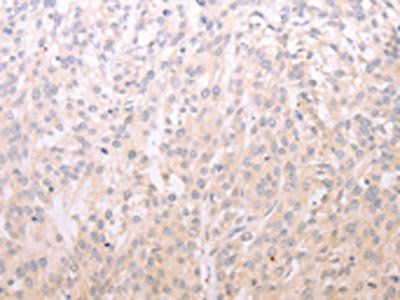 ADIPOR1 antibody