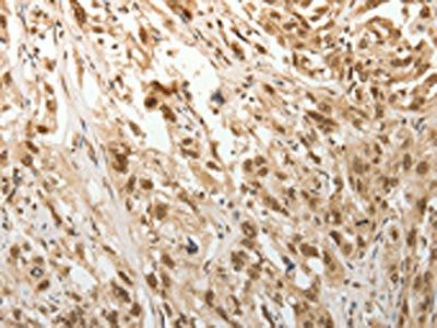 ADIPOR2 Antibody