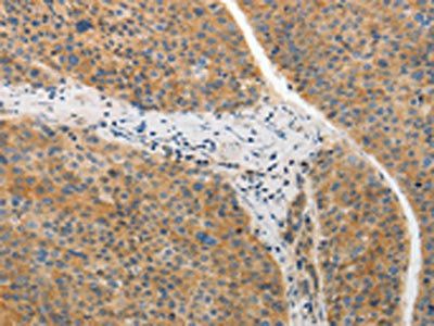 ADIPOR2 Antibody