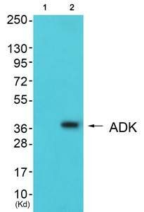 ADK Antibody
