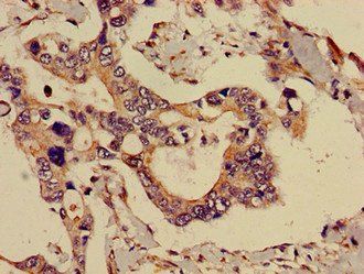 ADK Antibody