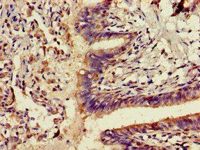 ADK Antibody