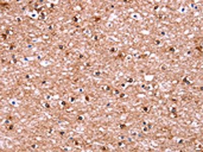 ADM2 Antibody