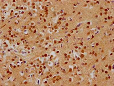 ADNP antibody