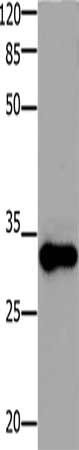 ADO antibody