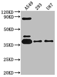ADORA1 Recombinant Monoclonal Antibody
