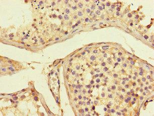 ADORA2A Antibody