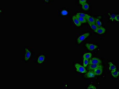 ADORA2B antibody