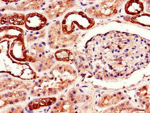 ADORA2B Antibody