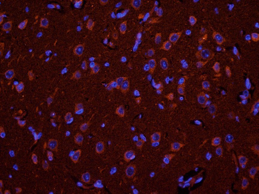 ADORA3 antibody