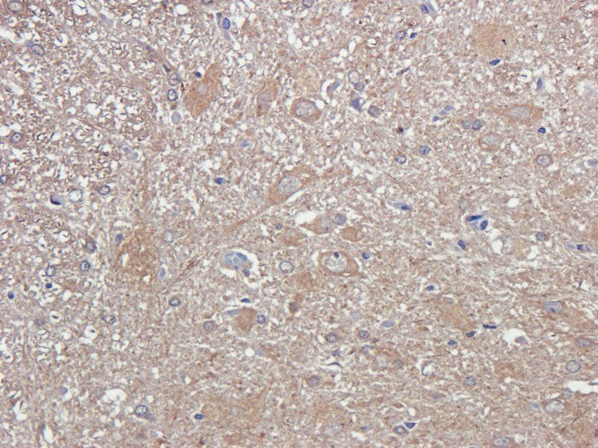 ADORA3 antibody