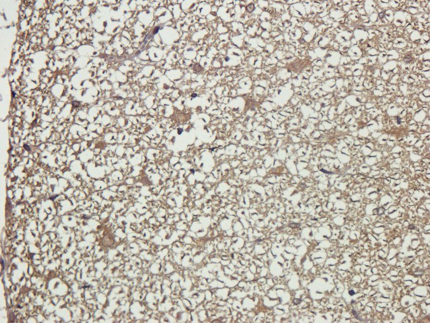 ADORA3 antibody