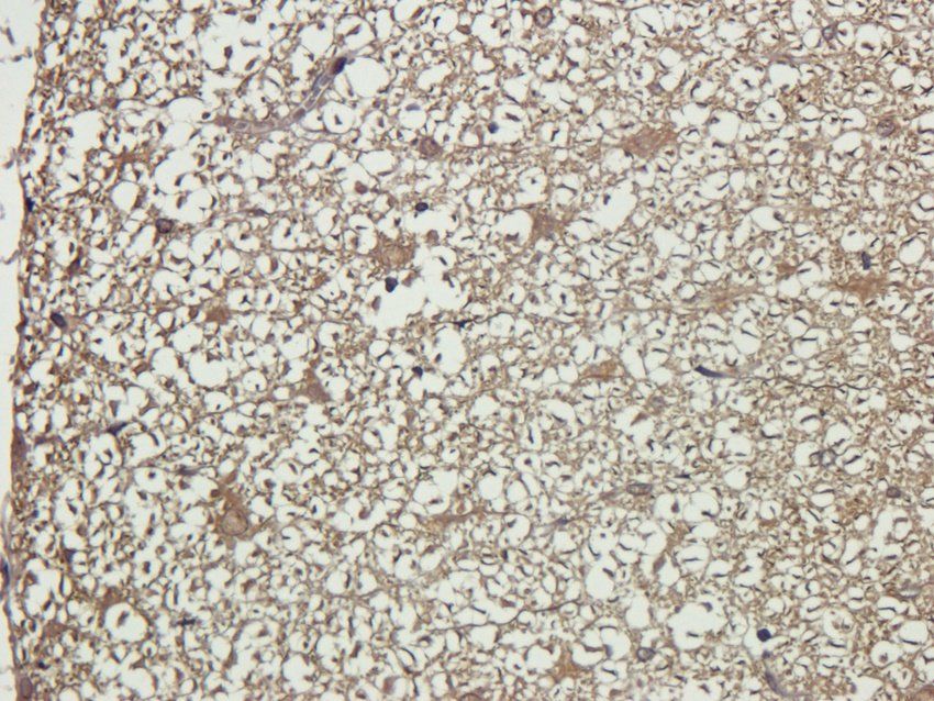 ADORA3 antibody