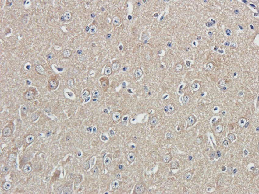 ADORA3 antibody