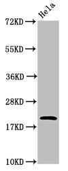 ADP-ribosylation factor 6 antibody