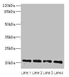 ADP-ribosylation factor 6 antibody