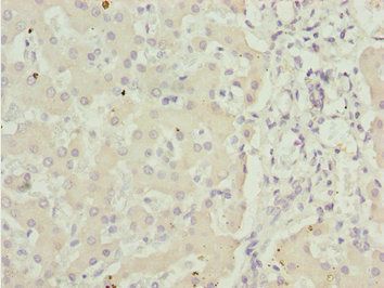 ADPGK Antibody