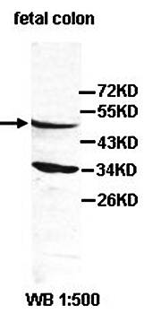 ADPGK Rabbit Polyclonal Antibody