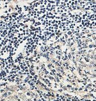 ADPGK Rabbit Polyclonal Antibody
