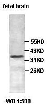 ADPRH antibody