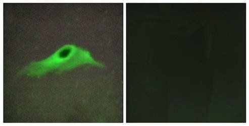 Collagen IV α5 Antibody
