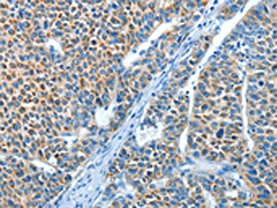 ADRA1B Antibody