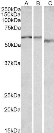 Goat anti-ADRA1B Antibody