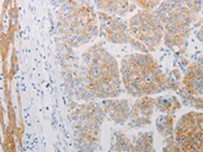 ADRB2 Antibody