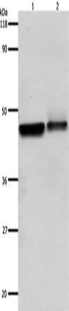 ADRB2 antibody