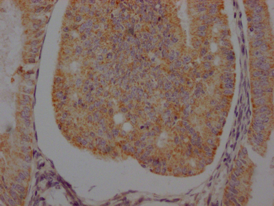 ADRB2 Recombinant Monoclonal Antibody