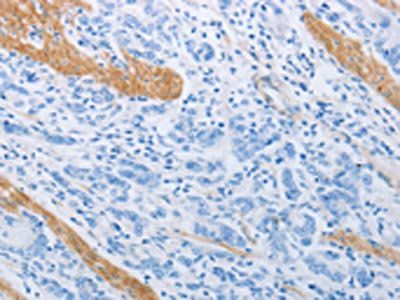 ADRB3 Antibody