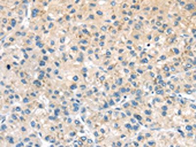 ADRB3 Antibody