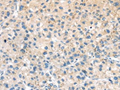 ADRB3 antibody