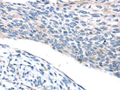 ADRB3 Antibody