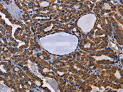 ADRBK2 Antibody