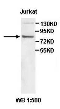 ADRBK2 antibody