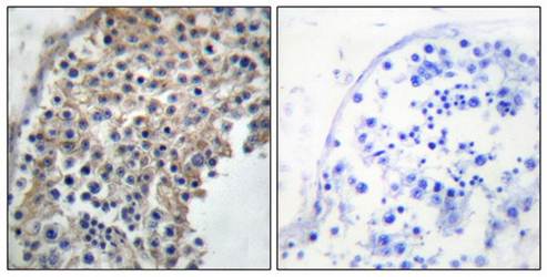 alpha 2a Adrenergic Receptor antibody