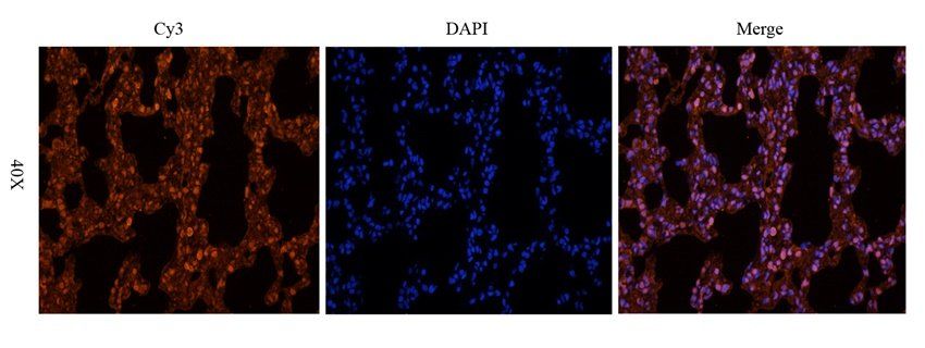 Adrenomedullin antibody