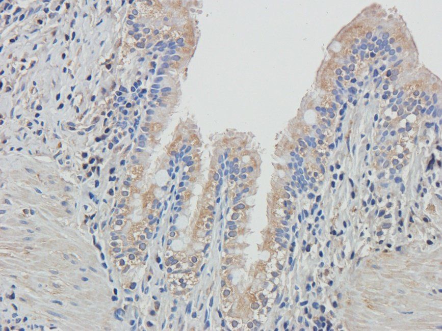 Adrenomedullin antibody