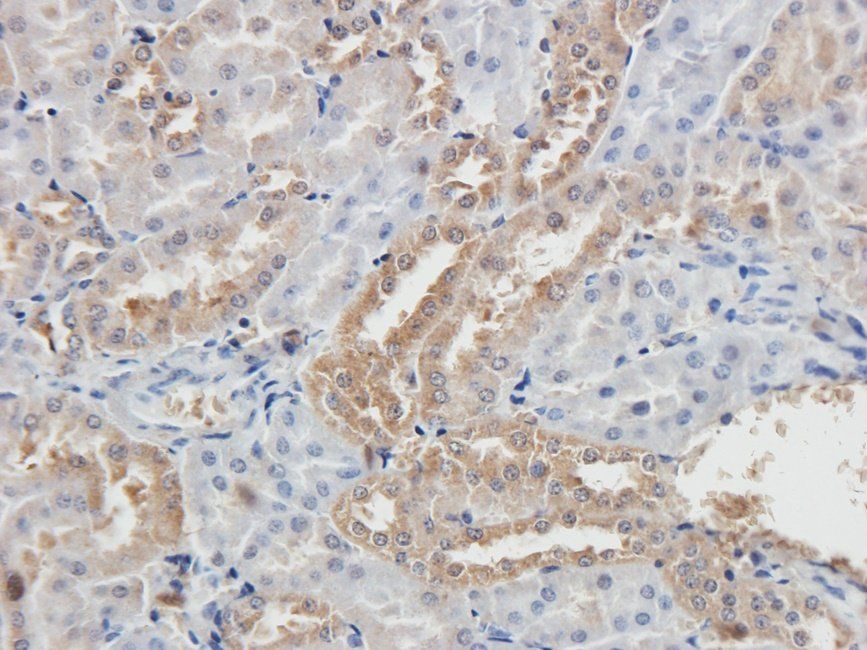 Adrenomedullin antibody