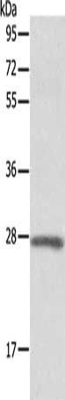 Adrenomedullin antibody