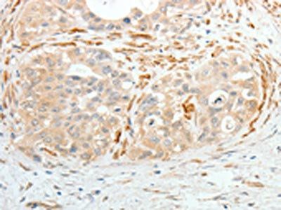 ADM Antibody