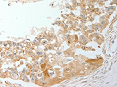 ADM Antibody
