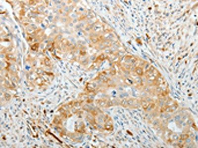 ADM Antibody