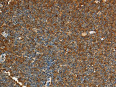 ADM Antibody